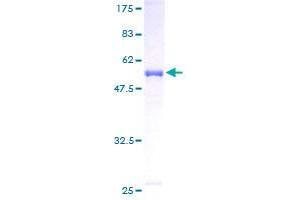 Image no. 1 for Calcyclin Binding Protein (CACYBP) (AA 1-228) protein (GST tag) (ABIN1347849)