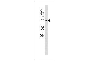 TUBD1 Antibody (C-term) (ABIN1881958 and ABIN2843289) western blot analysis in ZR-75-1 cell line lysates (35 μg/lane). (TUBD1 anticorps  (C-Term))