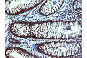 Immunohistochemistry (IHC) image for anti-Tubulin Folding Cofactor C (TBCC) antibody (ABIN1501323)