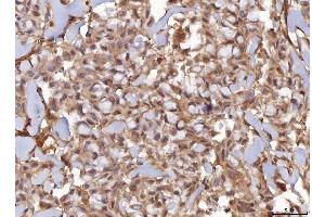 IHC analysis of AHA1/AHSA1 using anti-AHA1/AHSA1 antibody (ABIN7600708). (AHSA1 anticorps  (AA 221-264))