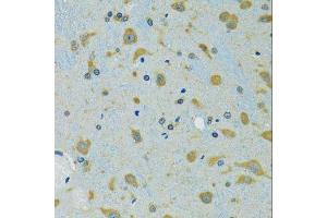 Immunohistochemistry of paraffin-embedded mouse brain using RPS7 antibody.