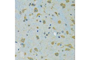 Immunohistochemistry of paraffin-embedded mouse brain using RPS7 antibody. (RPS7 anticorps  (AA 1-194))