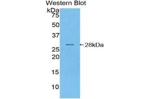 Western blot analysis of the recombinant protein. (NOD1 anticorps  (AA 612-826))