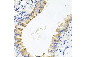 Immunohistochemistry of paraffin-embedded mouse lung using ALKBH8 antibody at dilution of 1:100 (x40 lens). (ALKBH8 anticorps)