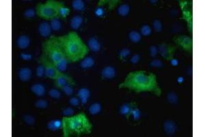 Anti-TBC1D4 mouse monoclonal antibody (ABIN2454437) immunofluorescent staining of COS7 cells transiently transfected by pCMV6-ENTRY TBC1D4 (RC212105). (TBC1D4 anticorps)