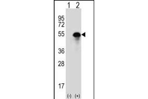 Western blot analysis of CA14 (arrow) using rabbit polyclonal CA14 Antibody (N-term) (ABIN391473 and ABIN2841441).