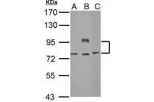 WB Image Sample (30 ug of whole cell lysate) A: Jurkat B: Raji C: NCI-H929 7.