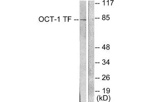 Western Blotting (WB) image for anti-POU Domain, Class 2, Transcription Factor 1 (POU2F1) (N-Term) antibody (ABIN1848704) (POU2F1 anticorps  (N-Term))