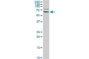 GRK6 monoclonal antibody (M06), clone 2G1.