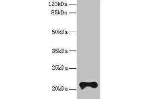 Western blot All lanes: TMEM154 antibody at 6 μg/mL + MCF-7 whole cell lysate Secondary Goat polyclonal to rabbit IgG at 1/10000 dilution Predicted band size: 21 kDa Observed band size: 21 kDa (TMEM154 anticorps  (AA 97-183))