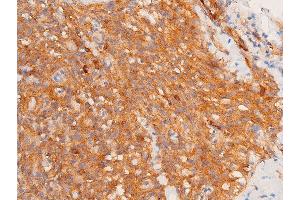 ABIN6267224 at 1/100 staining human lymphoid tissue sections by IHC-P. (CHEK1 anticorps  (pSer317))
