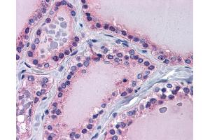 Immunohistochemistry (IHC) image for anti-Paired Box 8 (PAX8) (Middle Region) antibody (ABIN2775952) (PAX8 anticorps  (Middle Region))