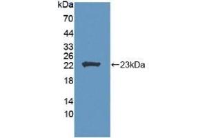 Detection of Recombinant LCAT, Human using Polyclonal Antibody to Lecithin Cholesterol Acyltransferase (LCAT) (LCAT anticorps  (AA 41-210))