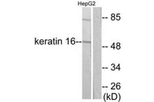 Western blot analysis of extracts from HepG2 cells, using Keratin 16 Antibody. (KRT16 anticorps  (AA 421-470))