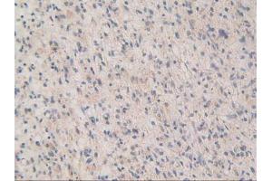 Figure. (MAPKAP Kinase 2 anticorps  (AA 139-367))