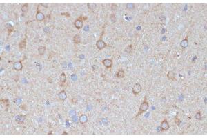 Immunohistochemistry of paraffin-embedded Rat brain using COPG2 Polyclonal Antibody at dilution of 1:100 (40x lens).