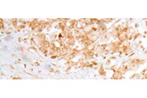 anti-MOB Kinase Activator 1B (MOB1B) antibody