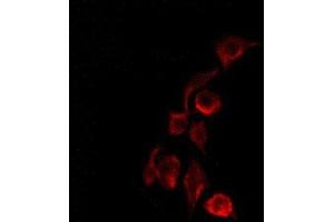 ABIN6275255 staining COLO205 by IF/ICC. (MEGF8 anticorps  (Internal Region))