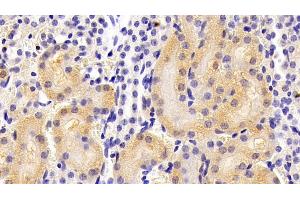 Detection of ALPL in Mouse Kidney Tissue using Polyclonal Antibody to Alkaline Phosphatase, Tissue-nonspecific (ALPL)