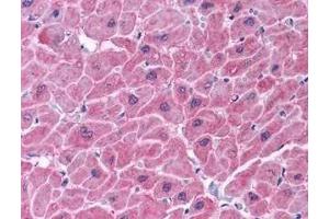 Immunohistochemistry of ARC in human heart tissue (A) and skeletal muscle (B) with ARC antibody at 5 μg/ml. (NOL3 anticorps  (C-Term))