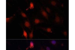 Immunofluorescence analysis of C6 cells using GBX2 Polyclonal Antibody at dilution of 1:100. (GBX2 anticorps)