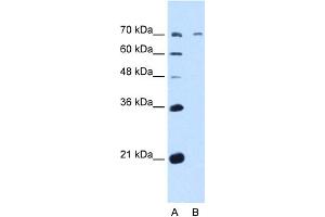 WB Suggested Anti-GALNT6 Antibody Titration:  5. (GALNT6 anticorps  (N-Term))
