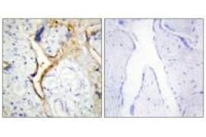 Immunohistochemistry analysis of paraffin-embedded human placenta tissue using CKI-ε antibody.