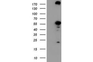Western Blotting (WB) image for anti-CNDP Dipeptidase 2 (Metallopeptidase M20 Family) (CNDP2) antibody (ABIN1497548) (CNDP2 anticorps)