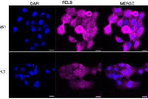 Immunocytochemical staining of HT- cells using RELB antibody (ABIN7800804), 1:1,000), Top panel: wild-type (WT), Bottom panal: RELB shRNA knockdown (KD). (Recombinant RELB anticorps)