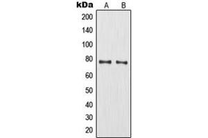 Western blot analysis of MMP9 expression in HT1080 (A), HuvEc (B) whole cell lysates. (MMP 9 anticorps  (C-Term))