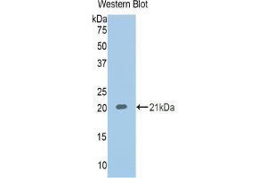 Western blot analysis of recombinant Human CBG. (SERPINA6 anticorps  (AA 218-378))