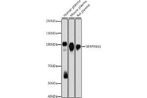 Western blot analysis of extracts of various cell lines, using SERPING1 antibody (ABIN7270250) at 1:1000 dilution.
