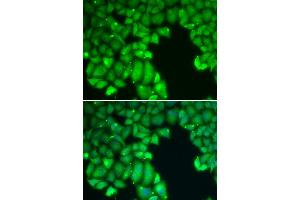 Immunofluorescence analysis of U2OS cells using CASP10 antibody (ABIN5970048). (Caspase 10 anticorps)
