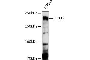 Western blot analysis of extracts of LNCaP cells, using CDK12 antibody (ABIN7266230) at 1:1000 dilution. (CDK12 anticorps  (AA 80-290))