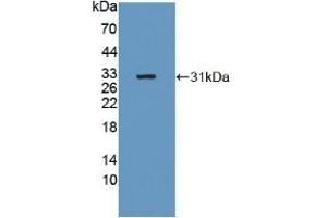 Detection of Recombinant b4GALNT2, Human using Polyclonal Antibody to Beta-1,4-N-Acetyl Galactosaminyl Transferase 2 (b4GALNT2) (B4GALNT2 anticorps  (AA 324-566))