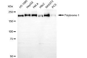 anti-Polybromo 1 (PBRM1) antibody
