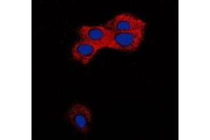 Immunofluorescent analysis of TGF beta 1 staining in MCF7 cells. (TGFB1 anticorps  (C-Term))