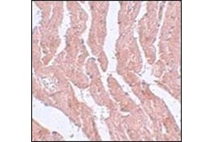 Immunohistochemistry of LZTR1 in mouse heart tissue with this product at 5 μg/ml.
