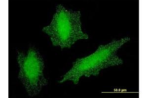 Immunofluorescence of monoclonal antibody to VHL on HeLa cell.