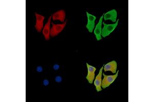 LZTS3 Antibody staining Hela cells by IF/ICC. (ProSAPiP1 anticorps)
