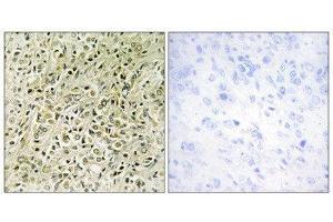 Immunohistochemistry (IHC) image for anti-Deleted in Liver Cancer 1 (DLC1) (N-Term) antibody (ABIN1849916) (DLC1 anticorps  (N-Term))