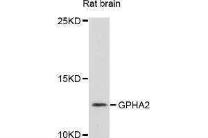 Western blot analysis of extracts of rat brain, using GPHA2 antibody (ABIN4903807) at 1:1000 dilution. (GPHa2 anticorps)