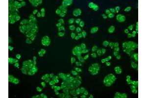 Image no. 5 for anti-Crystallin, alpha B (CRYAB) antibody (ABIN1497644) (CRYAB anticorps)