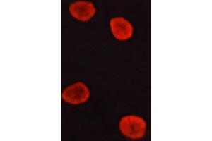 ABIN6266535 staining lovo cells by ICC/IF. (ERK1/2 anticorps)