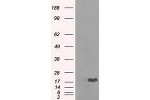 Image no. 8 for anti-Crystallin, alpha B (CRYAB) antibody (ABIN1497645) (CRYAB anticorps)