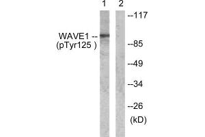 Western Blotting (WB) image for anti-WAS Protein Family, Member 1 (WASF1) (pTyr125) antibody (ABIN1847304)