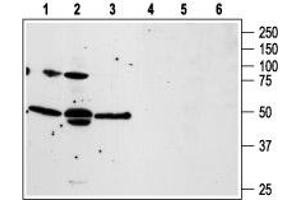 Western blot analysis of human prostate carcinoma PC3 (lanes 1 and 4), and LNCaP (lanes 2 and 5), and human T cell leukemia Jurkat (lanes 3 and 6) cell lines: - 1-3. (F2RL3 anticorps  (1st Extracellular Loop))