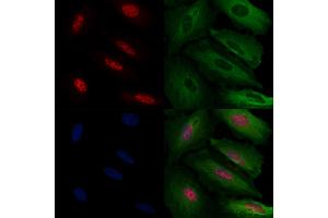 ABIN6263185 and ABIN6272471 staining  cells by IF/ICC. (MECP2 anticorps  (N-Term))