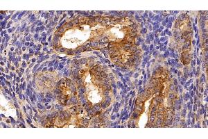 Detection of CK19 in Mouse Uterus Tissue using Polyclonal Antibody to Cytokeratin 19 (CK19)