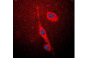 Immunofluorescent analysis of eNOS staining in MCF7 cells. (ENOS anticorps  (C-Term))